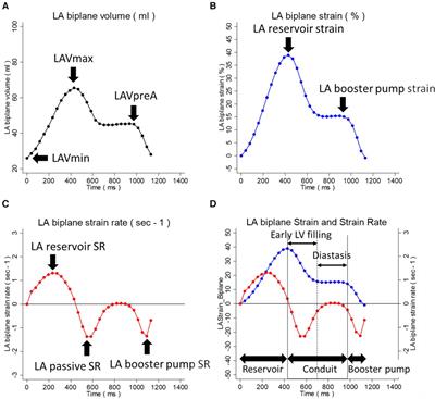 Left atrial diastasis strain slope is a marker of hemodynamic recovery in post-ST elevation myocardial infarction: the Laser Atherectomy for STemi, Pci Analysis with Scintigraphy Study (LAST-PASS)